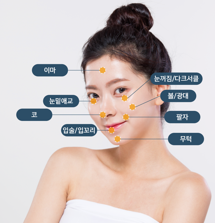 3D modeling volume dermal filler