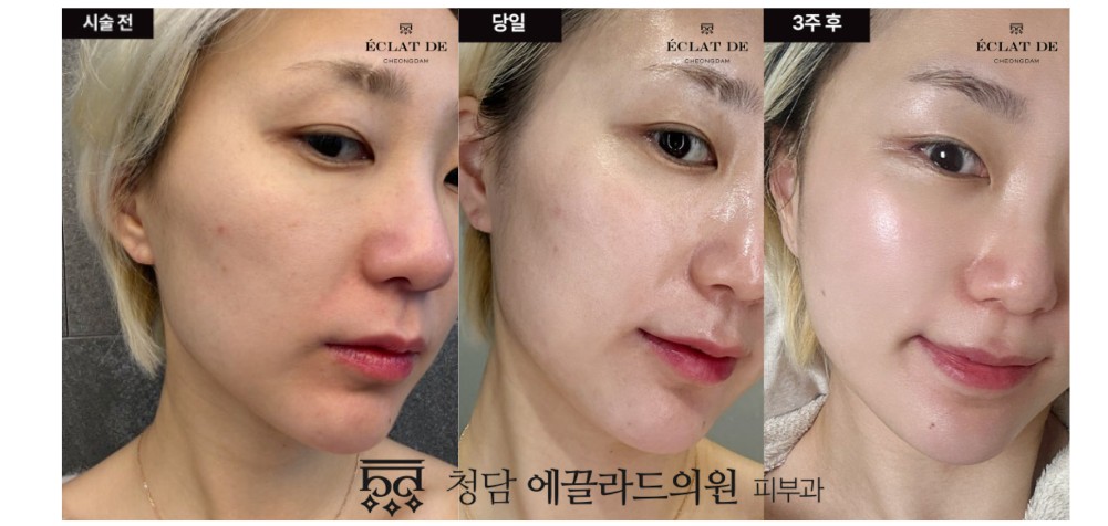 Skin Aura – Before & After from Eclat De