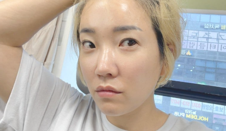 Rejuran Healer + Rejuran  (Eye) – Is It Worth It?