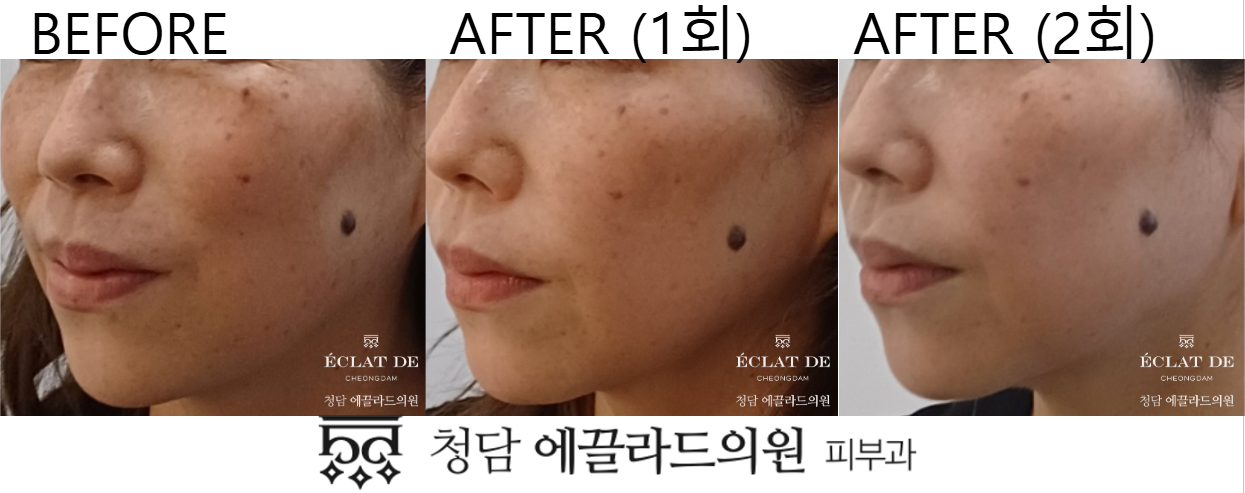 Dual Toning-Before and After from Eclat De