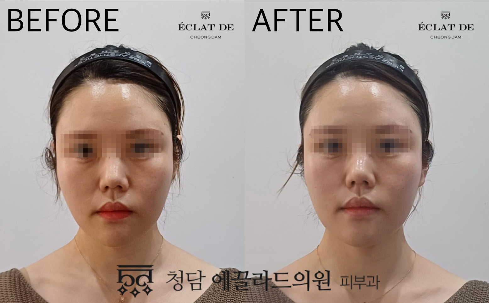Skin Aura – Before & After from Eclat De