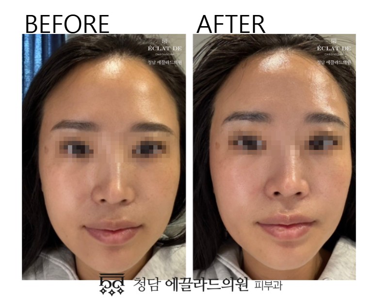 Corage 2.0-Before & After from Eclat De