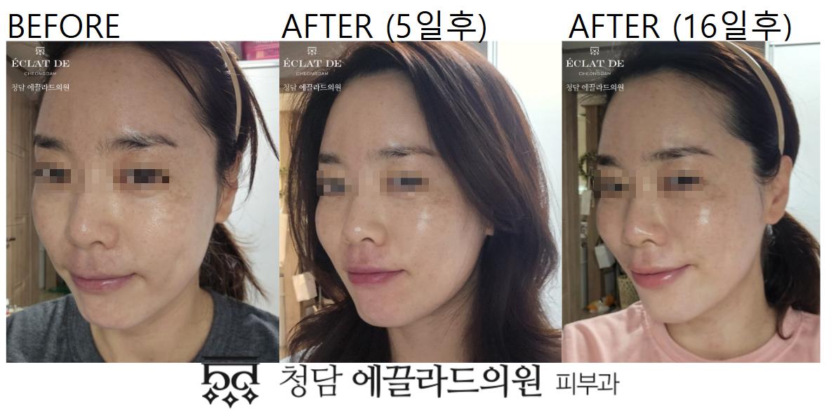 Corage 2.0-Before & After from Eclat De