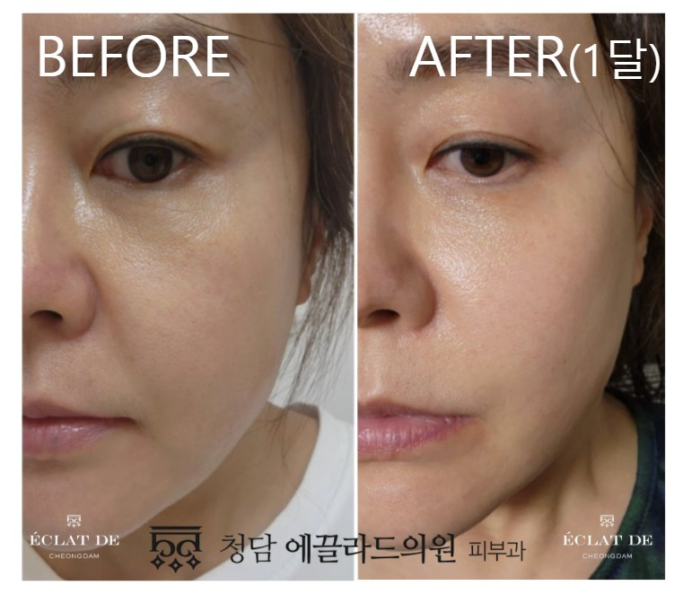 Skin Aura – Before & After from Eclat De