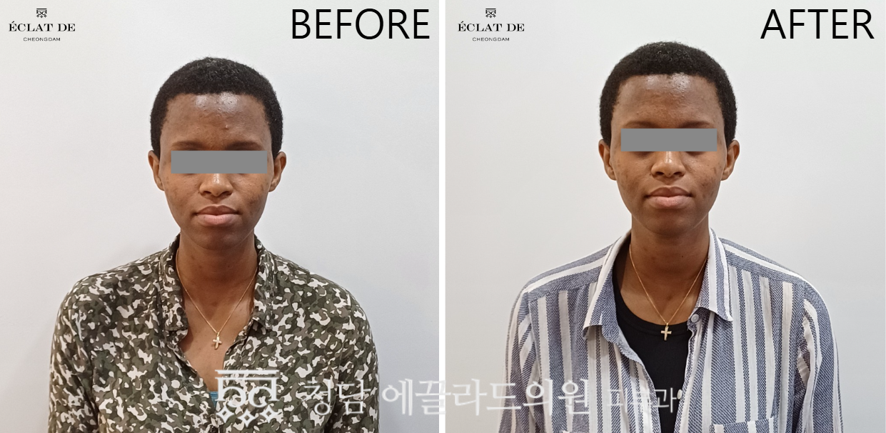 Corage 2.0 and Res Novae -Before & After from Eclat De