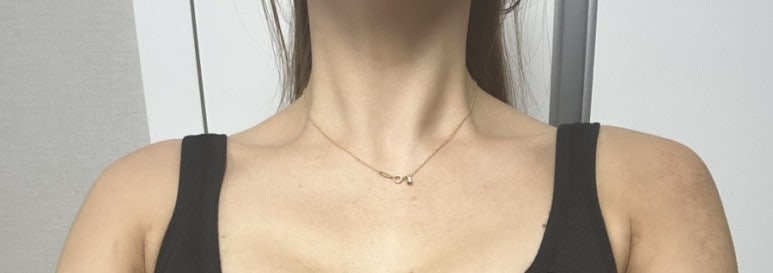 Xeomin Body Botox Review 