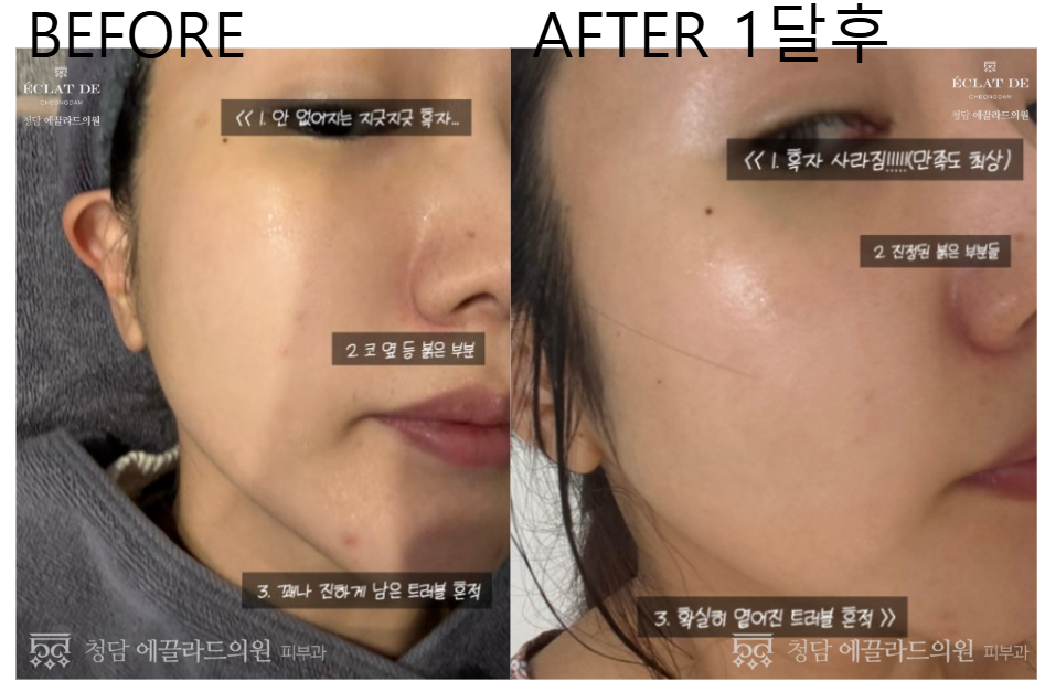Dual Toning - Before & After from Eclat De